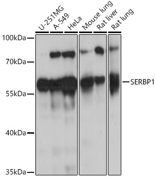 SERBP1 Rabbit Polyclonal Antibody