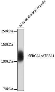 SERCA1/ATP2A1 Rabbit Monoclonal Antibody