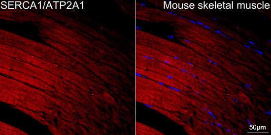 SERCA1/ATP2A1 Rabbit Monoclonal Antibody - Image 2