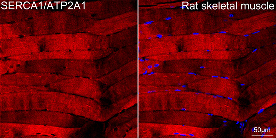 SERCA1/ATP2A1 Rabbit Monoclonal Antibody - Image 3