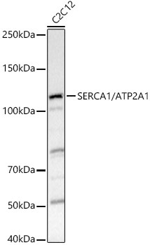 SERCA1/ATP2A1 Rabbit Polyclonal Antibody
