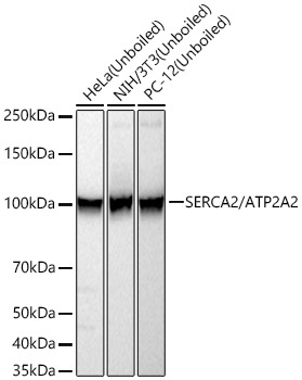 SERCA2/ATP2A2 Rabbit Monoclonal Antibody