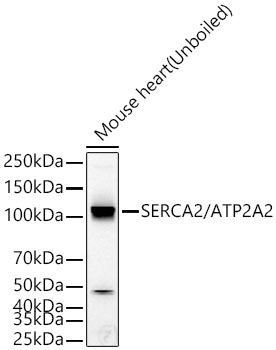 SERCA2/ATP2A2 Rabbit Monoclonal Antibody - Image 2
