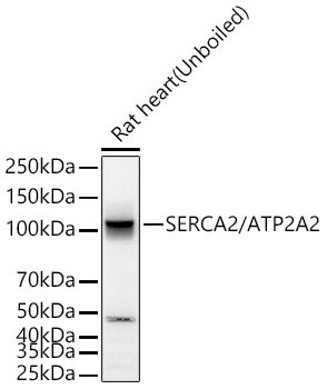 SERCA2/ATP2A2 Rabbit Monoclonal Antibody - Image 3