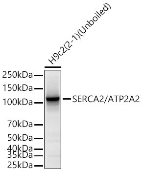 SERCA2/ATP2A2 Rabbit Monoclonal Antibody - Image 4