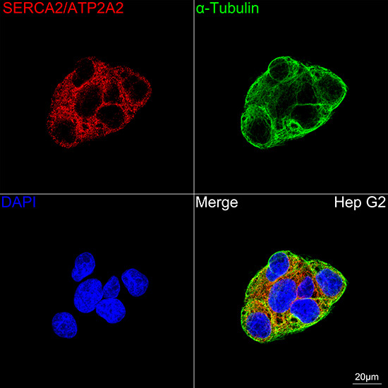 SERCA2/ATP2A2 Rabbit Monoclonal Antibody - Image 5