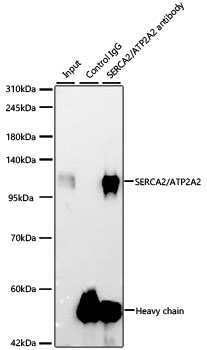 SERCA2/ATP2A2 Rabbit Monoclonal Antibody - Image 6