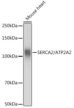SERCA2/ATP2A2 Rabbit Polyclonal Antibody