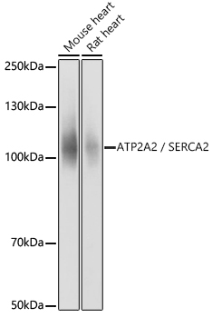 SERCA2/ATP2A2 Rabbit Polyclonal Antibody