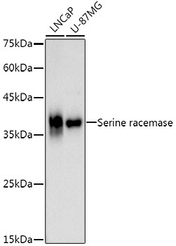 Serine racemase Rabbit Monoclonal Antibody