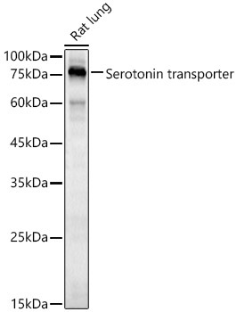 Serotonin transporter Rabbit Polyclonal Antibody