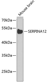 SERPINA12 Rabbit Polyclonal Antibody