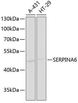 SERPINA6 Rabbit Polyclonal Antibody