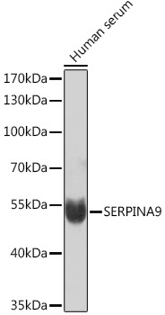 SERPINA9 Rabbit Polyclonal Antibody