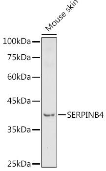 SERPINB4 Rabbit Polyclonal Antibody