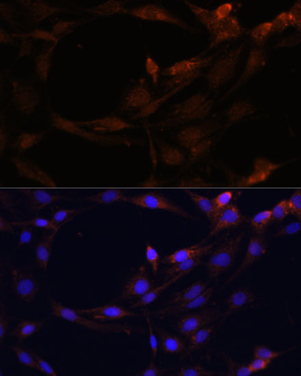 SERPINB9 Rabbit Polyclonal Antibody - Image 2