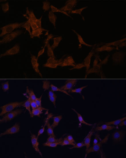 SERPINB9 Rabbit Polyclonal Antibody - Image 3