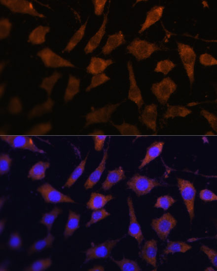 SERPINB9 Rabbit Polyclonal Antibody - Image 4