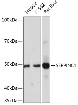 SERPINC1 Rabbit Monoclonal Antibody - Image 2