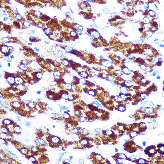 SERPINC1 Rabbit Monoclonal Antibody - Image 3