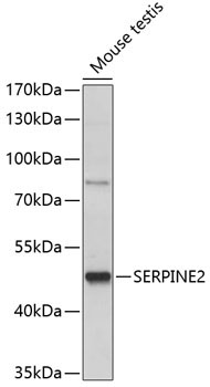 SERPINE2 Rabbit Polyclonal Antibody