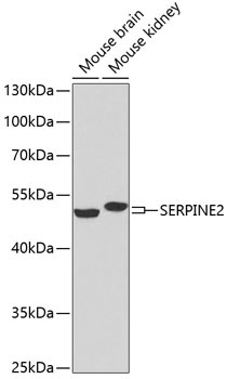 SERPINE2 Rabbit Polyclonal Antibody