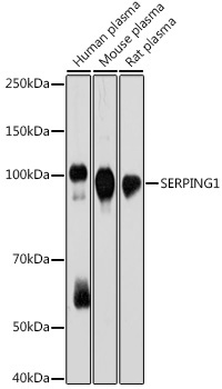 SERPING1 Rabbit Monoclonal Antibody
