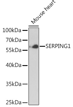 SERPING1 Rabbit Polyclonal Antibody