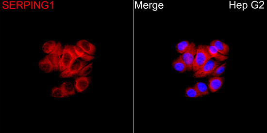 SERPING1 Rabbit Polyclonal Antibody - Image 2