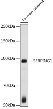SERPING1 Rabbit Polyclonal Antibody