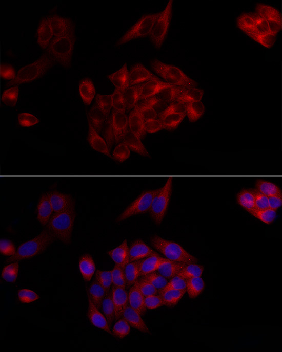 SERPING1 Rabbit Polyclonal Antibody - Image 2