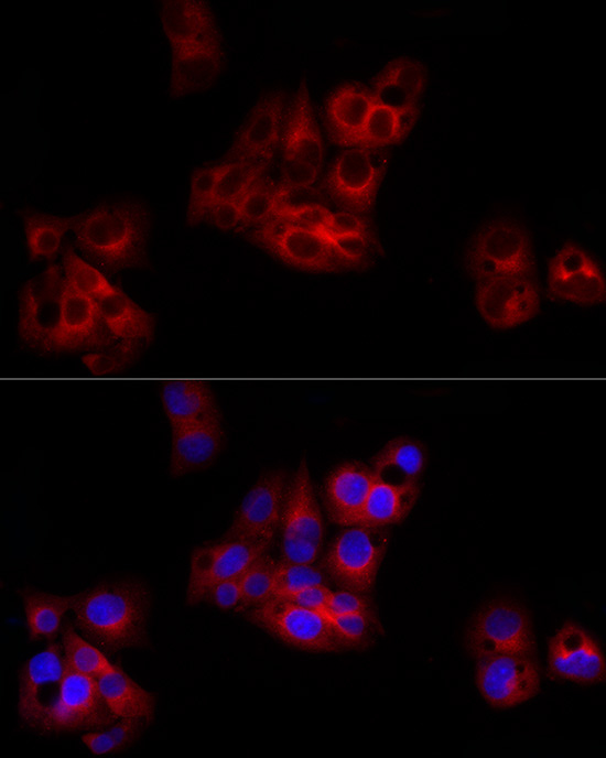 SERPING1 Rabbit Polyclonal Antibody - Image 3