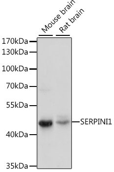 SERPINI1 Rabbit Polyclonal Antibody