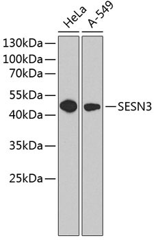SESN3 Rabbit Polyclonal Antibody