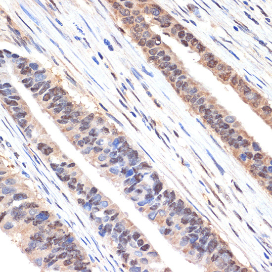 sestrin 1 Rabbit Monoclonal Antibody - Image 2