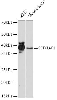 SET/TAF1 Rabbit Monoclonal Antibody