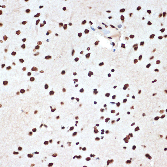SET/TAF1 Rabbit Monoclonal Antibody - Image 2