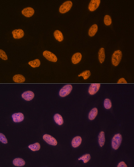 SET/TAF1 Rabbit Monoclonal Antibody - Image 5