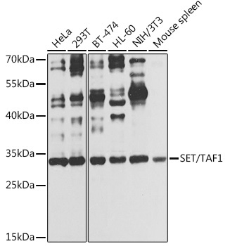 SET/TAF1 Rabbit Polyclonal Antibody