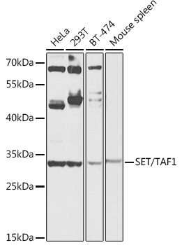 SET/TAF1 Rabbit Polyclonal Antibody