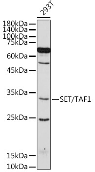 SET/TAF1 Rabbit Polyclonal Antibody