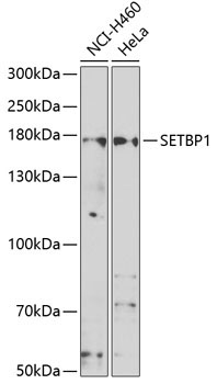 SETBP1 Rabbit Polyclonal Antibody