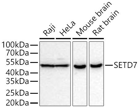 SETD7 Rabbit Monoclonal Antibody