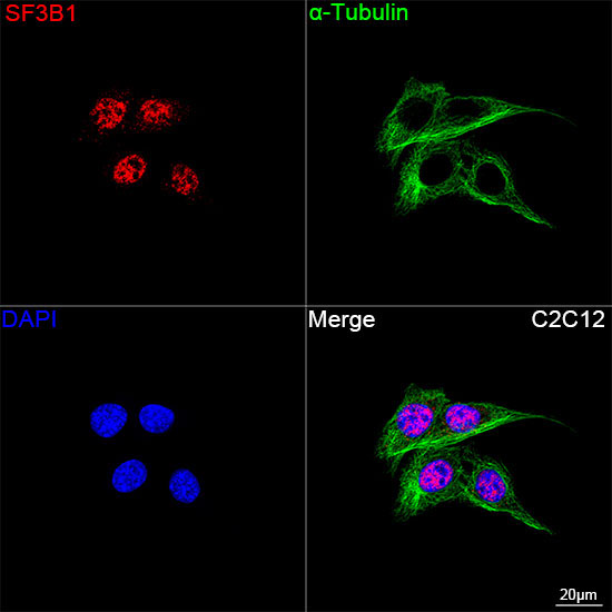 SF3B1 Rabbit Monoclonal Antibody - Image 2