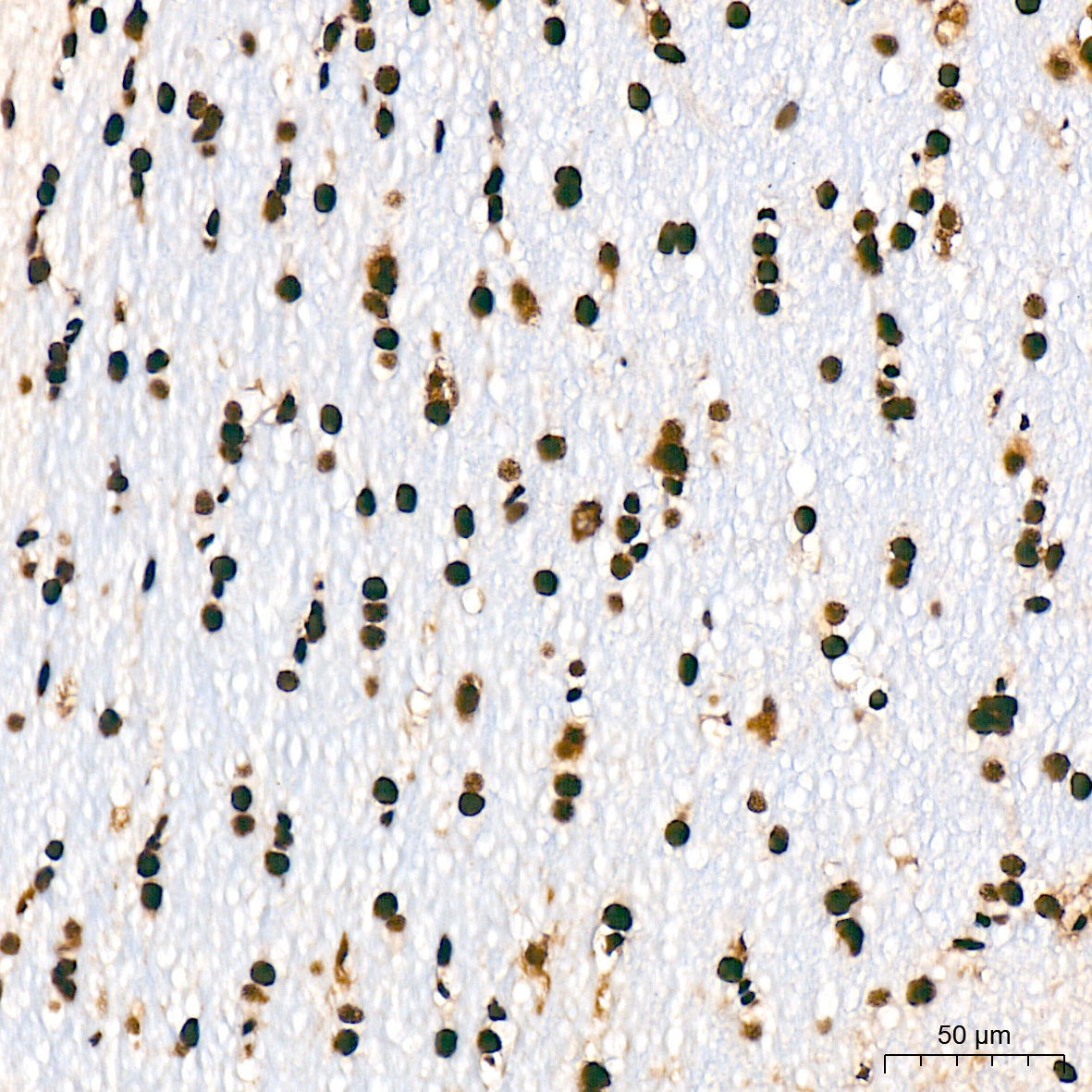 SF3B1 Rabbit Monoclonal Antibody - Image 3