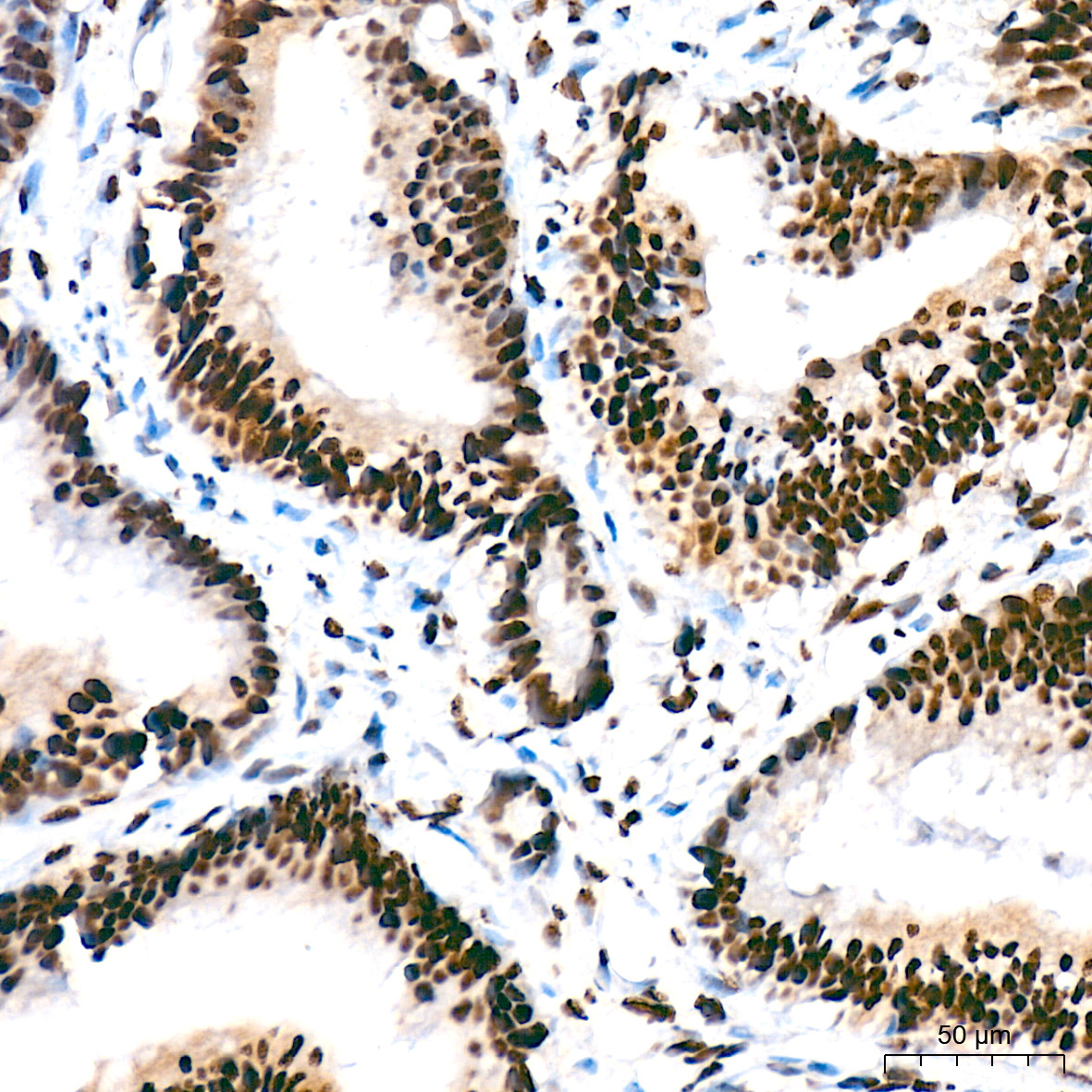 SF3B1 Rabbit Monoclonal Antibody - Image 4