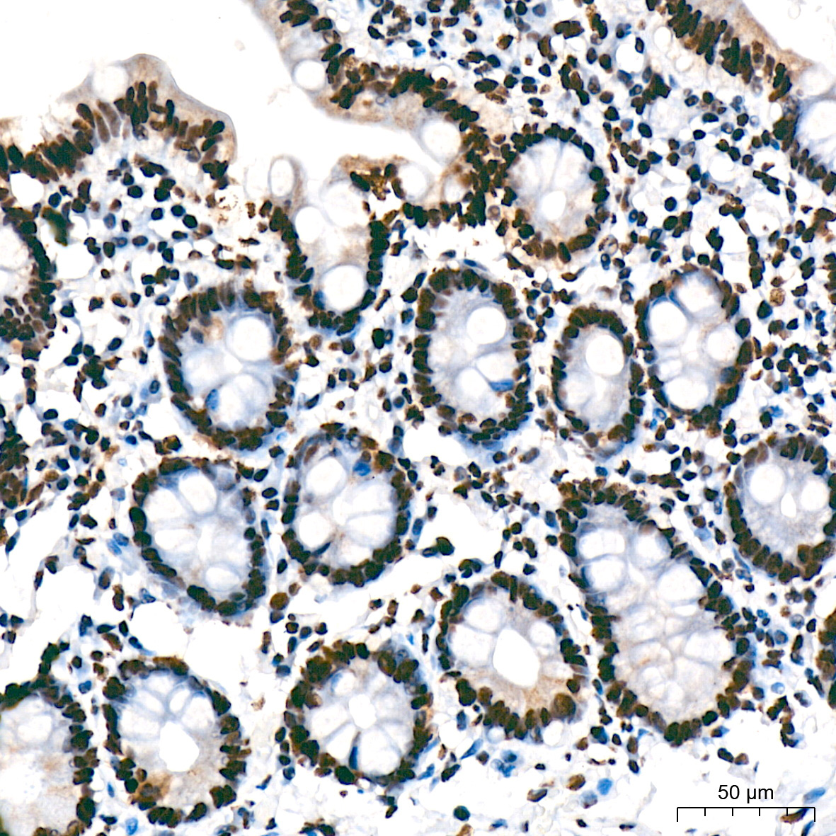 SF3B1 Rabbit Monoclonal Antibody - Image 5