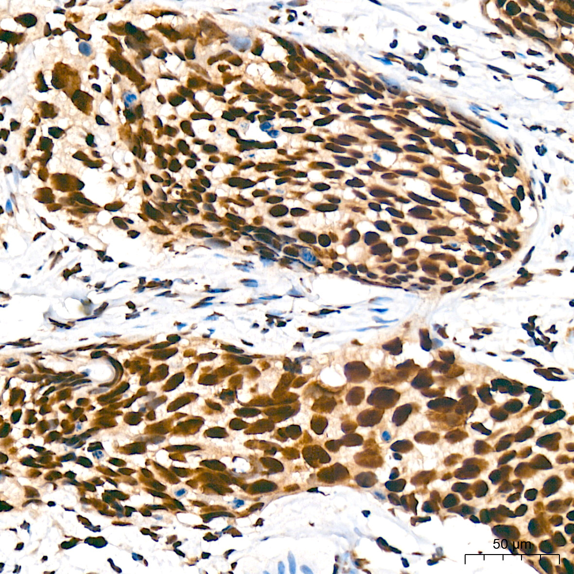 SF3B1 Rabbit Monoclonal Antibody - Image 8