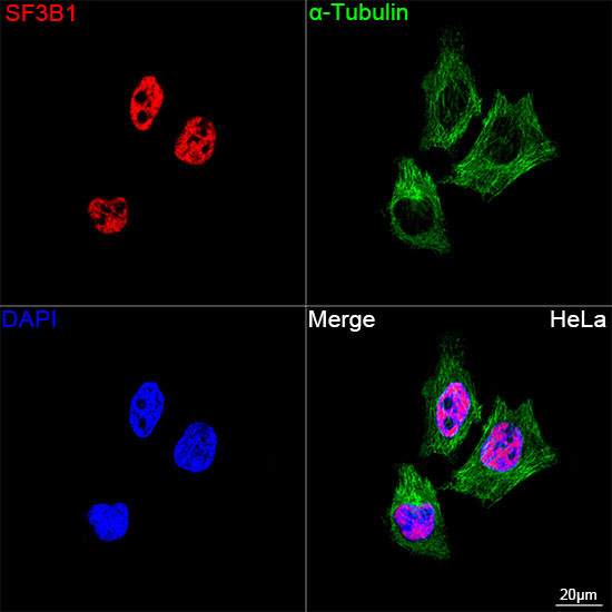 SF3B1 Rabbit Monoclonal Antibody - Image 9