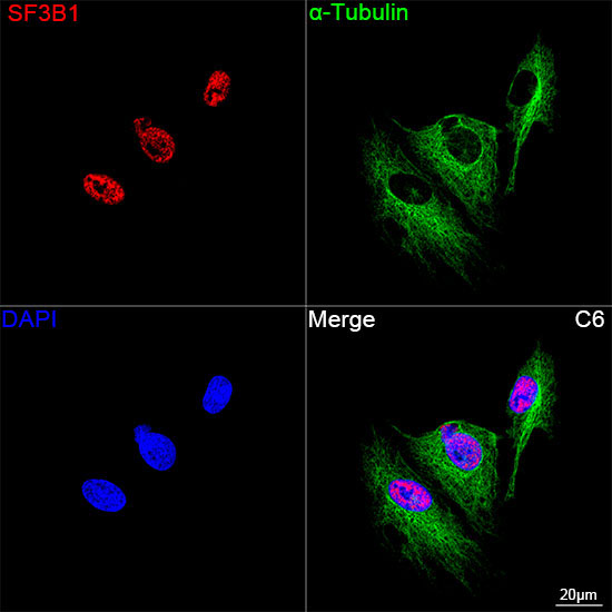 SF3B1 Rabbit Monoclonal Antibody - Image 10
